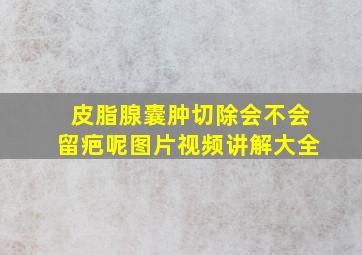 皮脂腺囊肿切除会不会留疤呢图片视频讲解大全