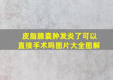 皮脂腺囊肿发炎了可以直接手术吗图片大全图解