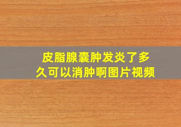 皮脂腺囊肿发炎了多久可以消肿啊图片视频