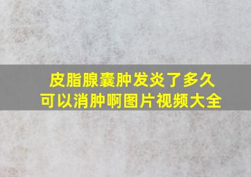 皮脂腺囊肿发炎了多久可以消肿啊图片视频大全