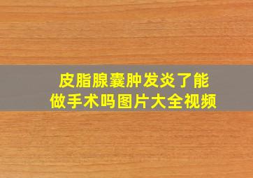 皮脂腺囊肿发炎了能做手术吗图片大全视频