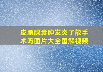 皮脂腺囊肿发炎了能手术吗图片大全图解视频