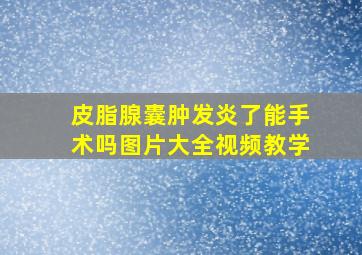 皮脂腺囊肿发炎了能手术吗图片大全视频教学