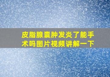 皮脂腺囊肿发炎了能手术吗图片视频讲解一下