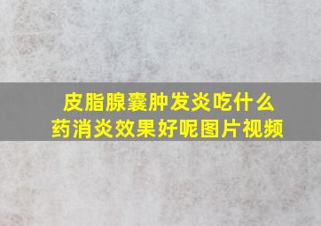 皮脂腺囊肿发炎吃什么药消炎效果好呢图片视频