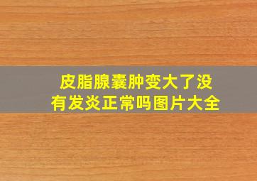 皮脂腺囊肿变大了没有发炎正常吗图片大全