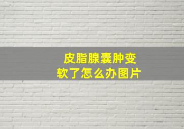 皮脂腺囊肿变软了怎么办图片