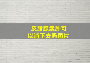 皮脂腺囊肿可以消下去吗图片