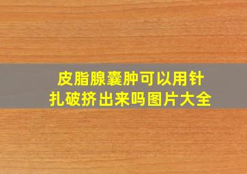 皮脂腺囊肿可以用针扎破挤出来吗图片大全