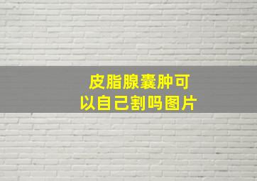 皮脂腺囊肿可以自己割吗图片