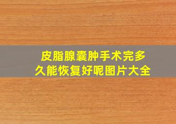 皮脂腺囊肿手术完多久能恢复好呢图片大全