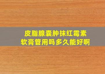 皮脂腺囊肿抹红霉素软膏管用吗多久能好啊