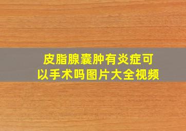 皮脂腺囊肿有炎症可以手术吗图片大全视频