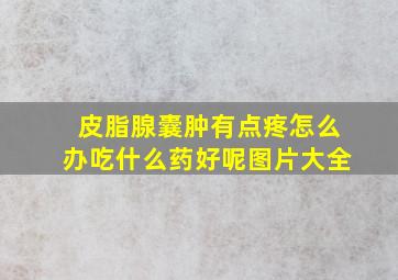 皮脂腺囊肿有点疼怎么办吃什么药好呢图片大全