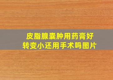 皮脂腺囊肿用药膏好转变小还用手术吗图片