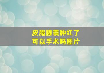 皮脂腺囊肿红了可以手术吗图片