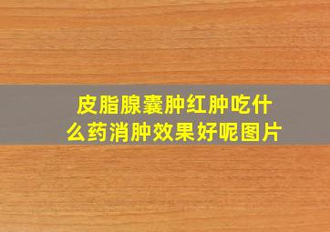 皮脂腺囊肿红肿吃什么药消肿效果好呢图片