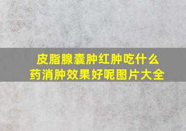 皮脂腺囊肿红肿吃什么药消肿效果好呢图片大全