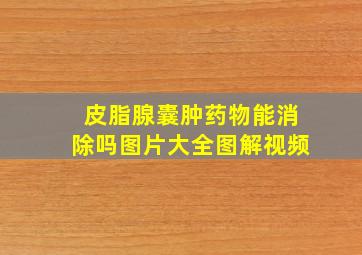 皮脂腺囊肿药物能消除吗图片大全图解视频