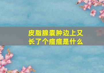 皮脂腺囊肿边上又长了个痘痘是什么