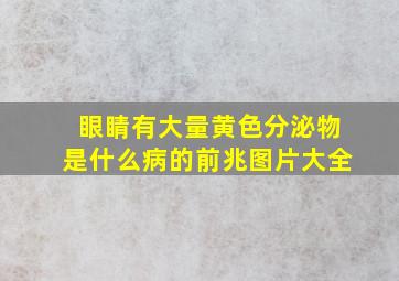 眼睛有大量黄色分泌物是什么病的前兆图片大全