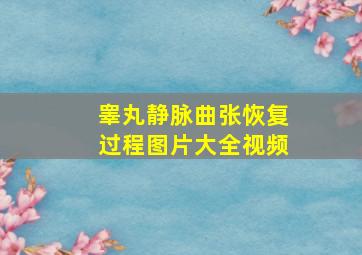 睾丸静脉曲张恢复过程图片大全视频