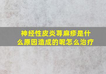 神经性皮炎荨麻疹是什么原因造成的呢怎么治疗