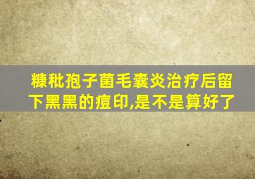 糠秕孢子菌毛囊炎治疗后留下黑黑的痘印,是不是算好了