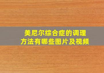 美尼尔综合症的调理方法有哪些图片及视频