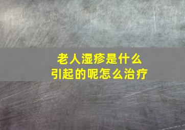 老人湿疹是什么引起的呢怎么治疗