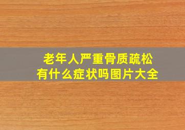 老年人严重骨质疏松有什么症状吗图片大全