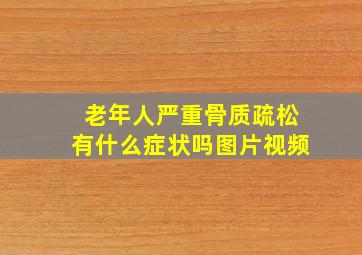 老年人严重骨质疏松有什么症状吗图片视频