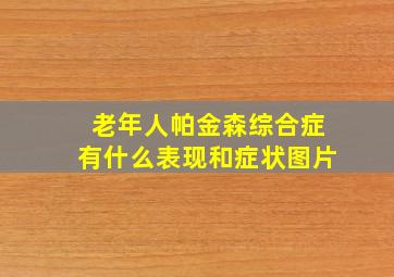 老年人帕金森综合症有什么表现和症状图片