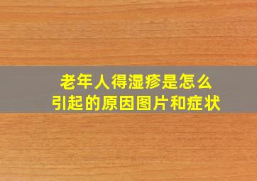 老年人得湿疹是怎么引起的原因图片和症状