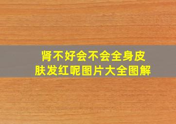 肾不好会不会全身皮肤发红呢图片大全图解