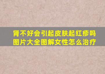 肾不好会引起皮肤起红疹吗图片大全图解女性怎么治疗