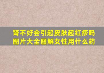 肾不好会引起皮肤起红疹吗图片大全图解女性用什么药