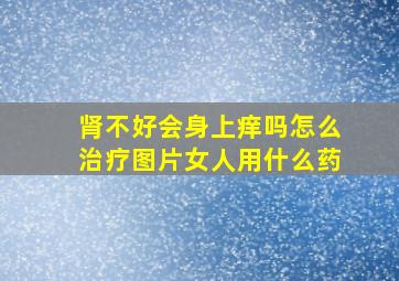 肾不好会身上痒吗怎么治疗图片女人用什么药