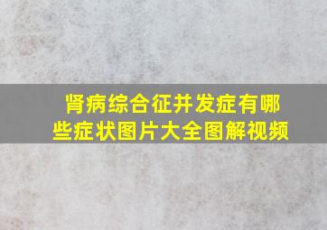 肾病综合征并发症有哪些症状图片大全图解视频