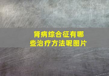 肾病综合征有哪些治疗方法呢图片