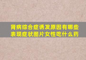 肾病综合症诱发原因有哪些表现症状图片女性吃什么药