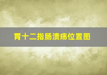 胃十二指肠溃疡位置图