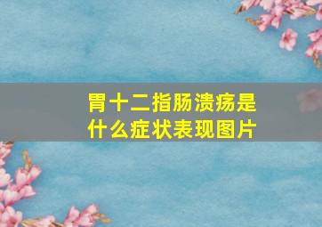 胃十二指肠溃疡是什么症状表现图片