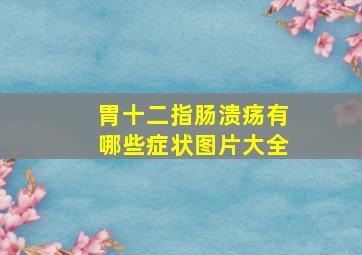 胃十二指肠溃疡有哪些症状图片大全