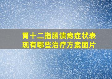 胃十二指肠溃疡症状表现有哪些治疗方案图片