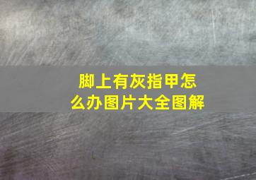 脚上有灰指甲怎么办图片大全图解