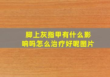 脚上灰指甲有什么影响吗怎么治疗好呢图片