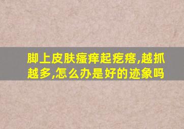 脚上皮肤瘙痒起疙瘩,越抓越多,怎么办是好的迹象吗