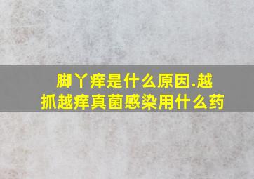 脚丫痒是什么原因.越抓越痒真菌感染用什么药