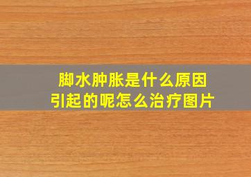 脚水肿胀是什么原因引起的呢怎么治疗图片